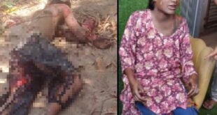 Set fire : प्रेम प्रसंग में युवक ने खुद और युवती को लगाई आग ?