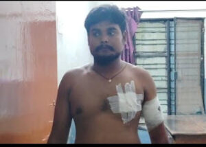 bike sawar badmashon ne:ऑटो चालक को दौड़ा कर मारी गोली, कोतवाली से महज 200 मीटर की दूरी पर वारदात*