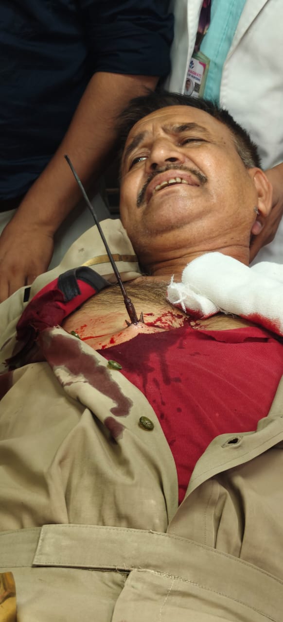 Accused in custody : लखनऊ CBI कार्यालय में हमला, ASI वीरेंद्र सिंह पर धनुष बाण से वार, आरोपी हिरासत में ?