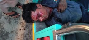 Two killed, one injured : दो बाइकों की आमने-सामने से भिड़ंत, दो की मौत, एक घायल; ओवरटेक करते समय हुआ हादसा ?