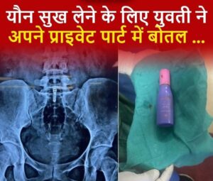 Surgery for a girl : दिल्ली में यौन जिज्ञासा में फंसी बोतल, युवती की सर्जरी कर निकाली गई ? 