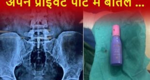 Surgery for a girl : दिल्ली में यौन जिज्ञासा में फंसी बोतल, युवती की सर्जरी कर निकाली गई ?