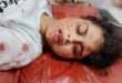 Unknown teenager : कन्हईपुर रेलवे ट्रैक पर घायल अवस्था में मिली अज्ञात किशोरी ?