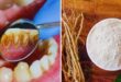 Natural remedies : घर पर बनाएं आयुर्वेदिक दंतमंजन दांतों और मसूड़ों के लिए प्रभावी और प्राकृतिक उपाय ?