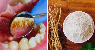 Natural remedies : घर पर बनाएं आयुर्वेदिक दंतमंजन दांतों और मसूड़ों के लिए प्रभावी और प्राकृतिक उपाय ?