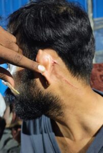 Serious allegations : लखनऊ ट्रामा सेंटर में नर्सिंग ऑफिसर पर जानलेवा हमला, मेडिकल स्टूडेंट्स के खिलाफ गंभीर आरोप ?