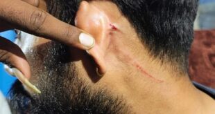 Serious allegations : लखनऊ ट्रामा सेंटर में नर्सिंग ऑफिसर पर जानलेवा हमला, मेडिकल स्टूडेंट्स के खिलाफ गंभीर आरोप ?