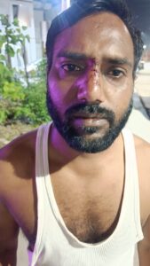 While drinking alcohol : हापुड़ में शराब पीने के दौरान दो व्यक्तियों में हुई मारपीट चार व्यक्ति हुआ़ घायल ?