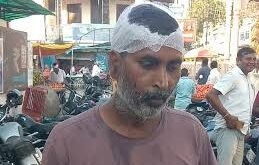 A fight between : जमीनी विवाद में 10 लोग घायल:मड़ियाहूं में दो पक्षों के बीच हुई मारपीट ?