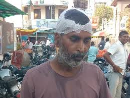 A fight between : जमीनी विवाद में 10 लोग घायल:मड़ियाहूं में दो पक्षों के बीच हुई मारपीट ?