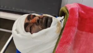 Anas is fighting with burning : बुढ़ाना में नई SOG टीम पर गंभीर आरोप अनस जलकर लड़ रहा, कार्रवाई अब भी लंबित ?