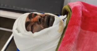 Anas is fighting with burning : बुढ़ाना में नई SOG टीम पर गंभीर आरोप अनस जलकर लड़ रहा, कार्रवाई अब भी लंबित ?