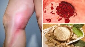 Thick blood, : अटैक, कोलेस्ट्रॉल, थकान-कमजोरी 20 रोगों की जड़ है गाढ़ा खून, Ayurveda का देसी नुस्खा 15 दिन में पतला कर देगा खून ?