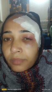 Entering women's : हापुड़ में मामूली कहासुनी के बाद हिंसक हमला, घर में घुसकर महिलाओं से मारपीट व छेड़छाड़, दो घायल ?