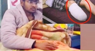 The girlfriend revealed the secret : जौनपुर का चौंकाने वाला मामला: MBBS दाखिले के लिए छात्र ने किया खुद को विकलांग, गर्लफ्रेंड ने खुलासा किया राज