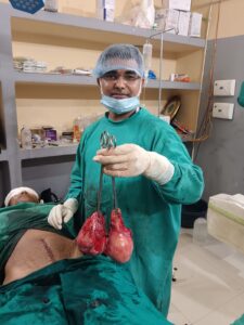 Intestinal cancer was found : स्वस्थ जीवन जीने वाले 36 वर्षीय व्यक्ति को अंतिम चरण का आंतों का कैंसर मिला ?