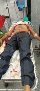 Tragic accident on the bridge : लखनऊ में पतंग के मांझे ने ली एक और जान, हैदरगंज ओवर ब्रिज पर दर्दनाक हादसा