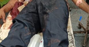 Tragic accident on the bridge : लखनऊ में पतंग के मांझे ने ली एक और जान, हैदरगंज ओवर ब्रिज पर दर्दनाक हादसा