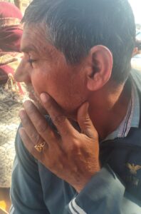 A complaint was filed : जाटौली गांव में प्लॉट विवाद: लोहे की रॉड से हमला, घायल जोगेंद्र सिंह ने दर्ज कराई शिकायत