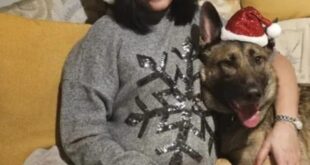 All four limbs : घर में पालतू कुत्ता और स्वास्थ्य जोखिम: महिला को पालतू कुत्ते के चाटने से हुआ सेप्सिस, खो दिए चारों हाथ-पैर