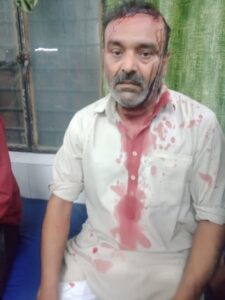 Deadly attack : मुजफ्फरनगर कश्यप चौक पर बदमाशों ने पिता-पुत्र पर किया जानलेवा हमला
