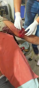 Questions over Security : शामली में पत्रकार पर जानलेवा हमला, मंदिर विवाद से जुड़ी हिंसा ने उठाए सुरक्षा पर सवाल