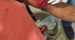 Questions over Security : शामली में पत्रकार पर जानलेवा हमला, मंदिर विवाद से जुड़ी हिंसा ने उठाए सुरक्षा पर सवाल