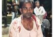 Search for the Accused : जौनपुर में बसपा नेता अजय गौतम पर जानलेवा हमला, पुलिस जांच तेज आरोपियों की तलाश