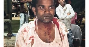 Search for the Accused : जौनपुर में बसपा नेता अजय गौतम पर जानलेवा हमला, पुलिस जांच तेज आरोपियों की तलाश