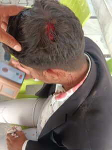 Outrage Among Lawyers : जौनपुर में अधिवक्ता अंबे पांडेय पर जानलेवा हमला, वकीलों में आक्रोश और पुलिस जांच तेज
