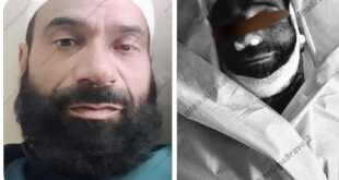 Unknown Assailant : इस्लामाबाद में हिजबुल आतंकी की रहस्यमयी मौत, ‘अज्ञात हमलावर’ फिर चर्चा में
