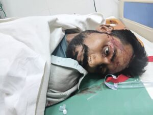 Appeal for identification : हाफिजपुर क्षेत्र में सड़क दुर्घटना में घायल युवक की मौत, पहचान कराने की अपील