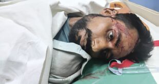 Appeal for identification : हाफिजपुर क्षेत्र में सड़क दुर्घटना में घायल युवक की मौत, पहचान कराने की अपील