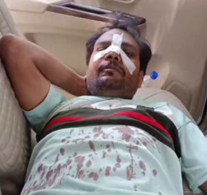 Police have launched an investigation : जौनपुर में युवक पर बदमाशों का हमला, गंभीर घायल, पुलिस जांच में जुटी