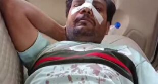 Police have launched an investigation : जौनपुर में युवक पर बदमाशों का हमला, गंभीर घायल, पुलिस जांच में जुटी