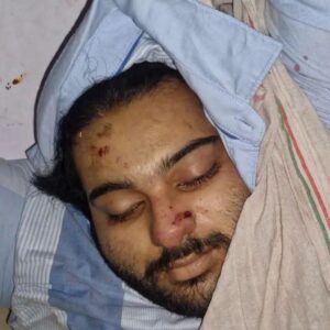 Tragic accident : झांसी सड़क हादसे में अतीक अहमद के बेटे अबान की मौत, भाई से मिलने जाते समय हुआ दर्दनाक हादसा