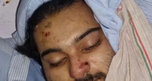 Tragic accident : झांसी सड़क हादसे में अतीक अहमद के बेटे अबान की मौत, भाई से मिलने जाते समय हुआ दर्दनाक हादसा