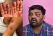 Police Brutality : मेरठ में किसान नेताओं की कथित पिटाई पर विवाद, पुलिस पर बर्बरता के आरोपों की जांच शुरू ?