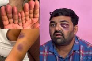 Police Brutality : मेरठ में किसान नेताओं की कथित पिटाई पर विवाद, पुलिस पर बर्बरता के आरोपों की जांच शुरू ?