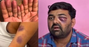 Police Brutality : मेरठ में किसान नेताओं की कथित पिटाई पर विवाद, पुलिस पर बर्बरता के आरोपों की जांच शुरू ?