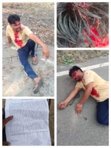 Accusation of attack : मिर्जापुर में पैसों के लेनदेन को लेकर दो पक्ष भिड़े, फरमान पर कुल्हाड़ी से हमले का आरोप ?