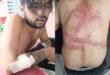 Allegation of assault : कानपुर होटल ग्रैंड ओयो कर्मचारियों पर युवक से मारपीट का आरोप, तस्वीरें मीडिया पर वायरल