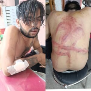 Allegation of assault : कानपुर होटल ग्रैंड ओयो कर्मचारियों पर युवक से मारपीट का आरोप, तस्वीरें मीडिया पर वायरल