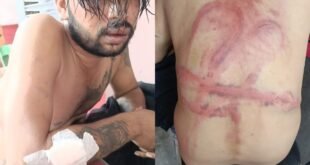 Allegation of assault : कानपुर होटल ग्रैंड ओयो कर्मचारियों पर युवक से मारपीट का आरोप, तस्वीरें मीडिया पर वायरल