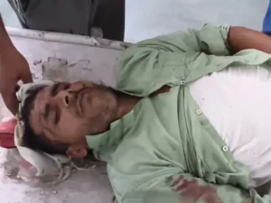 Police check : भंडारा करने को लेकर विवाद, मारपीट में दो लोग घायल; लाठी-डंडों से हमला करने का आरोप, पुलिस जांच में जुटी